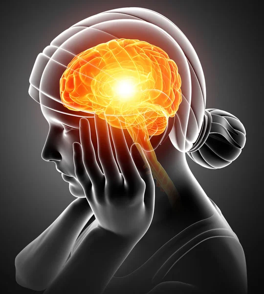Donne Sensazione di mal di testa — Foto Stock