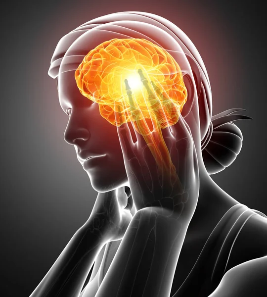 Frauen spüren Kopfschmerzen — Stockfoto