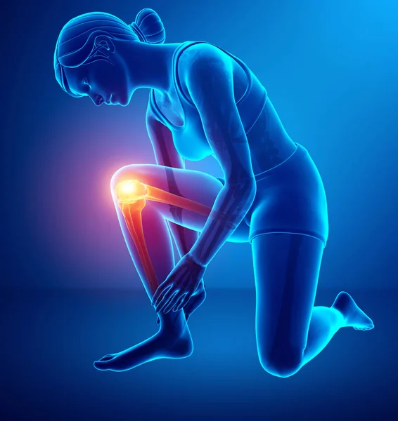 Γυναικών γόνατο πόνος στις αρθρώσεις — Φωτογραφία Αρχείου