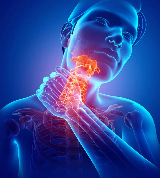 stock image Male Feeling the Neck Pain