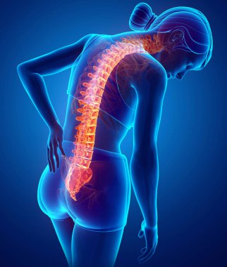 Geri ağrı hissi kadınlar 