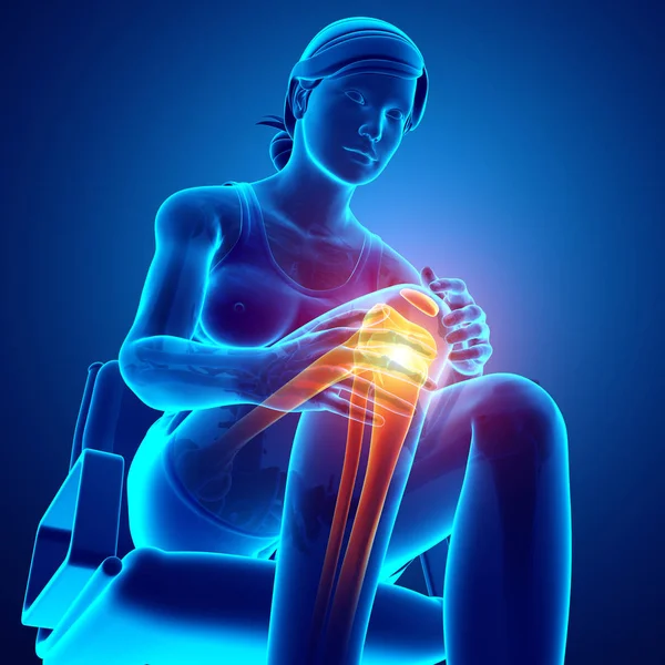 Mujer Knee dolor articular —  Fotos de Stock