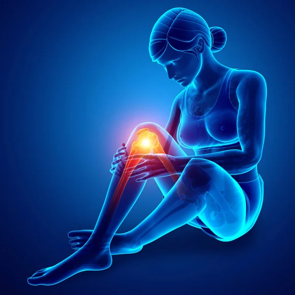 Women Knee joint pain — Stock Photo, Image