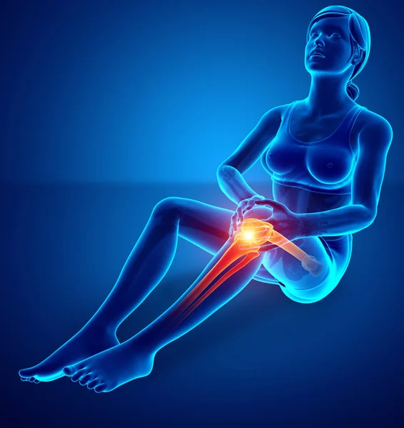 Femmes Douleurs articulaires du genou — Photo