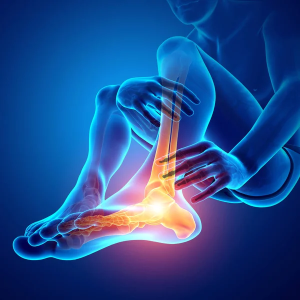 Erkek ayak ayak bileği ağrısı ile — Stok fotoğraf