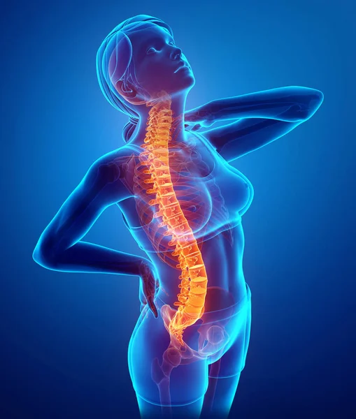 Mulheres sentindo dor nas costas — Fotografia de Stock