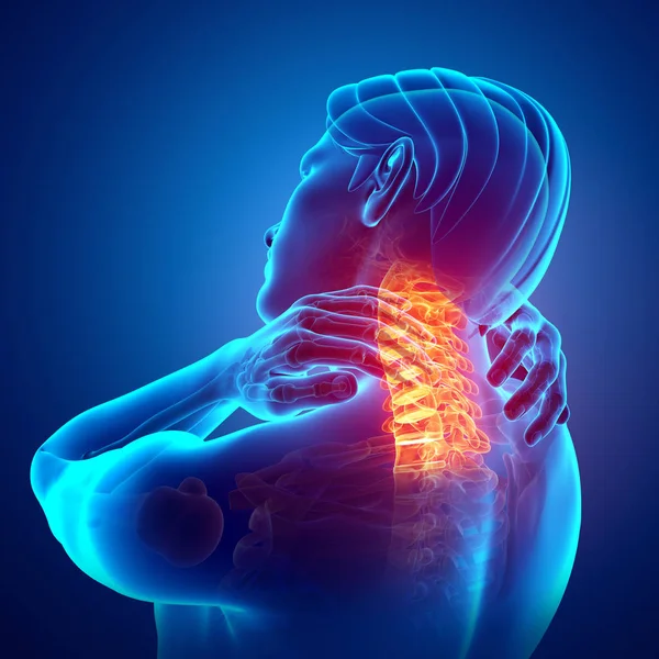 Male Feeling the Neck Pain — Stock Photo, Image