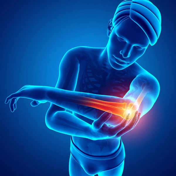 Men Feeling Elbow pain — Stock Photo, Image