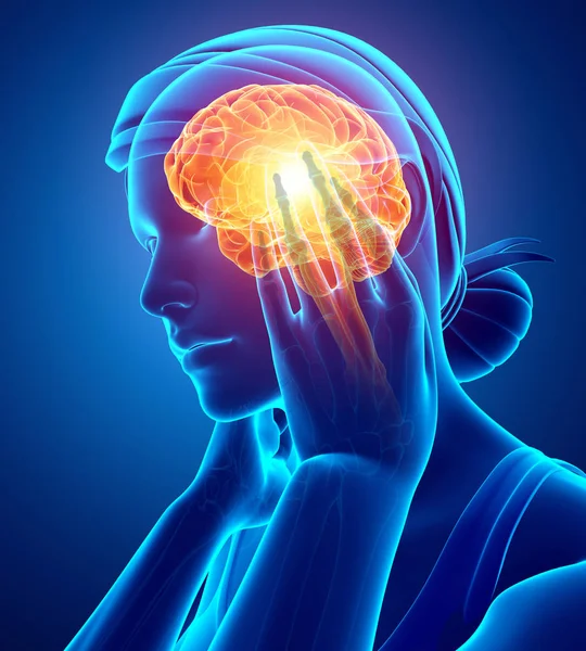 Women Feeling Headache — Stock Photo, Image