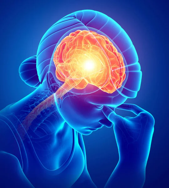 Kobieta czuje ból głowy — Zdjęcie stockowe