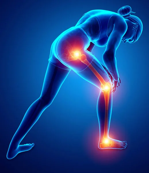 Vrouwelijke gezamenlijke beenpijn — Stockfoto