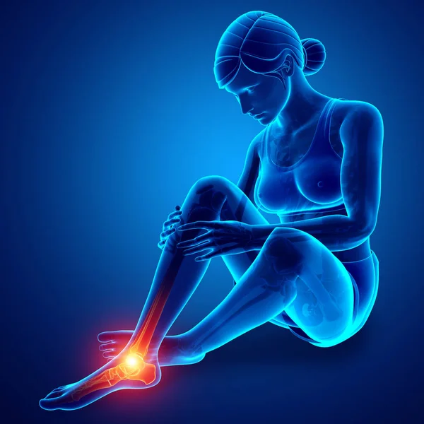 Female foot with ankle pain — Stock Photo, Image