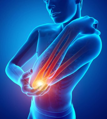 Erkekler duygu dirsek ağrısı