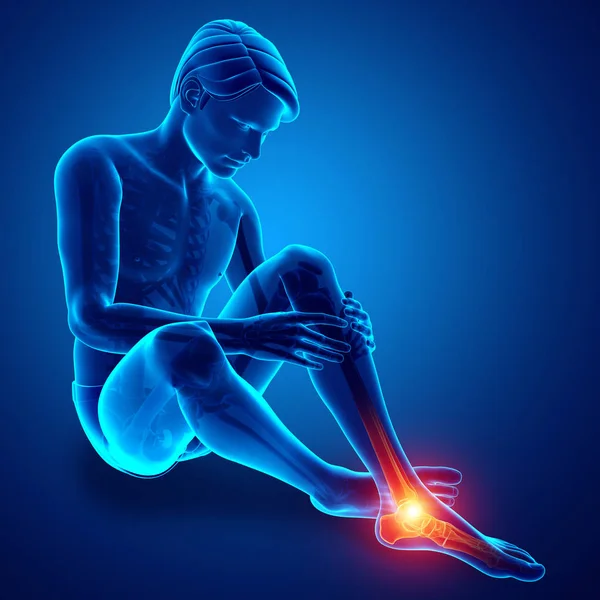 Pé masculino com dor no tornozelo — Fotografia de Stock