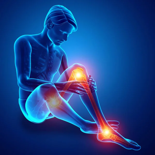 Bóle stawów mężczyzna noga — Zdjęcie stockowe