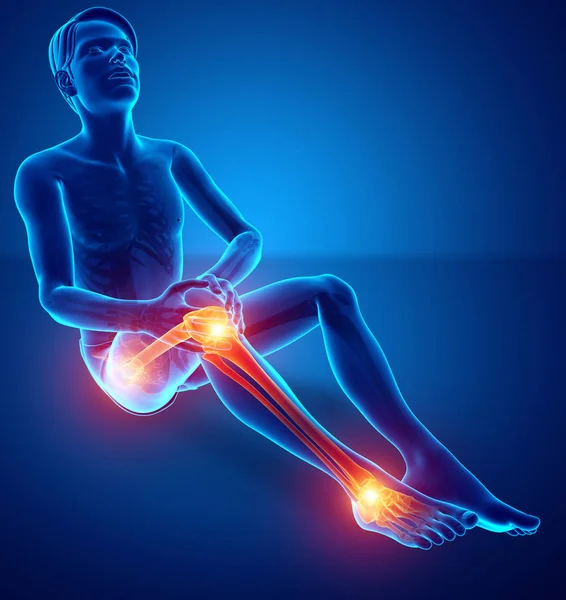 Dor nas articulações das pernas masculinas — Fotografia de Stock