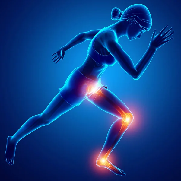 Female Leg joint pain