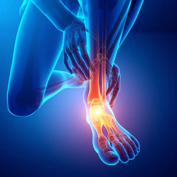 Male foot with ankle pain — Stock Photo, Image