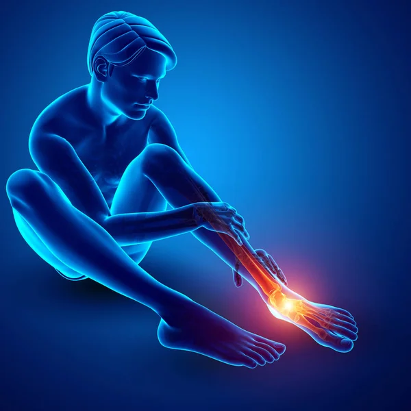 Мужская нога с болью в лодыжке — стоковое фото