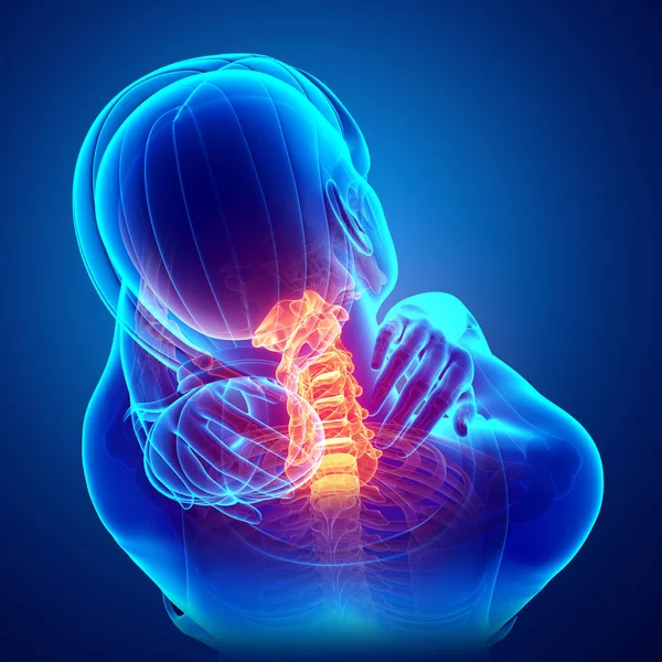 Women Feeling the Neck Pain — Stock Photo, Image