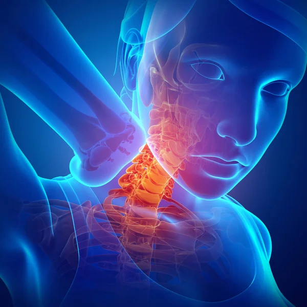 Women Feeling the Neck Pain — Stock Photo, Image