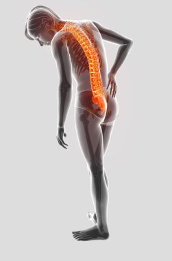 sırt ağrısı duygu erkek 3D çizimi