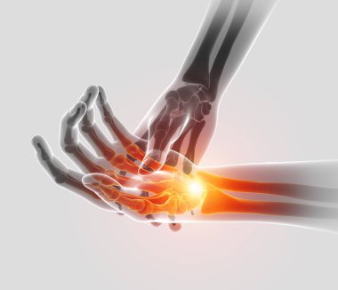 3D çizim erkekler duygu dirsek ağrısı