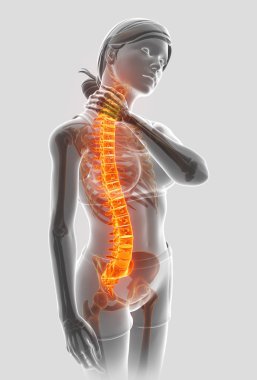 3D illüstrasyon kadın duygu sırt ağrısı