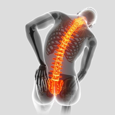sırt ağrısı duygu erkek 3D çizimi
