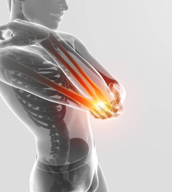 3D çizim erkek duygu dirsek ağrısı