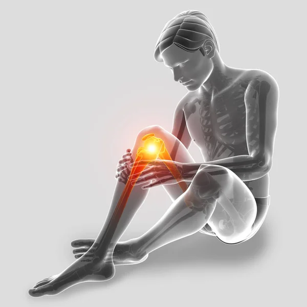 3d Illustration of Male feeling Knee pain — Stock Photo, Image