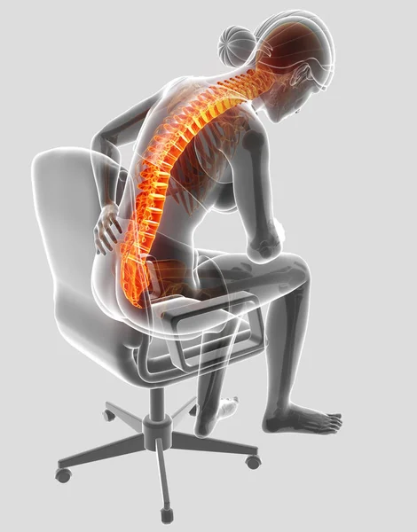 Illustration 3D de la femme Ressentir le mal de dos — Photo
