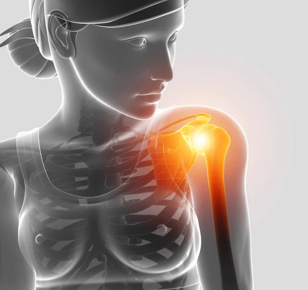 3d Illustration of Female Feeling the Shoulder Pain — Stock Photo, Image