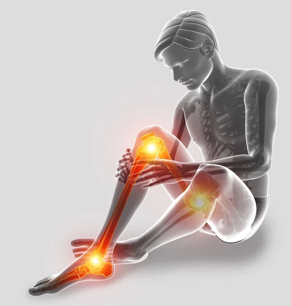 3D ilustracja ból w nodze — Zdjęcie stockowe