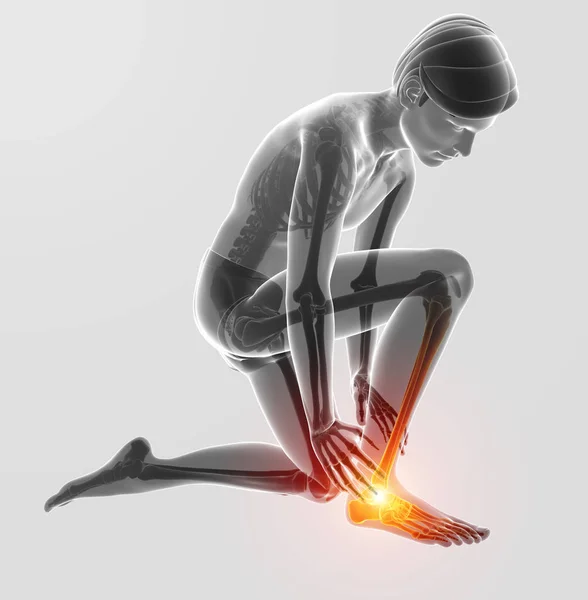 3d Illustration of Male foot with ankle pain — Stock Photo, Image