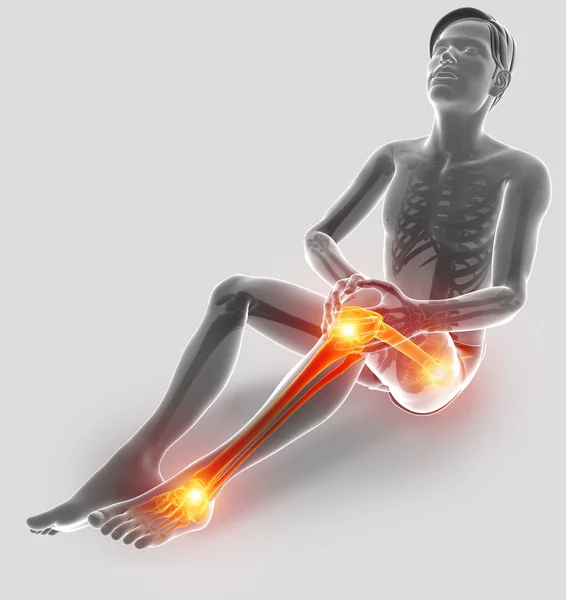 3d Illustration of Pain in leg