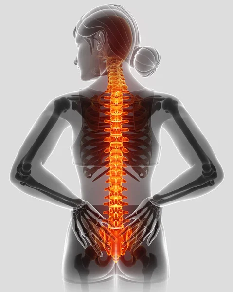 3D ilustracja kobiece uczucie bólu pleców — Zdjęcie stockowe