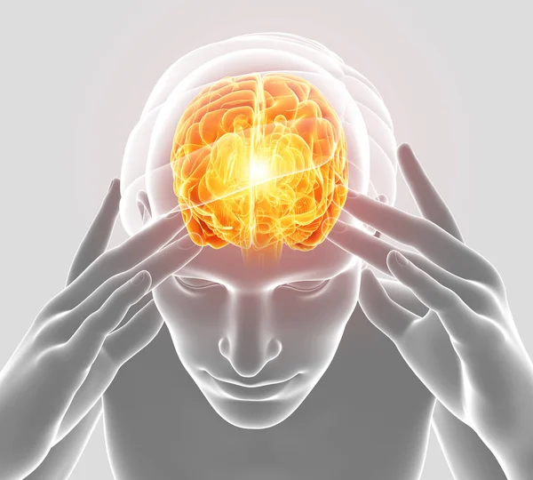 3D illustration av manliga känsla huvudvärk — Stockfoto