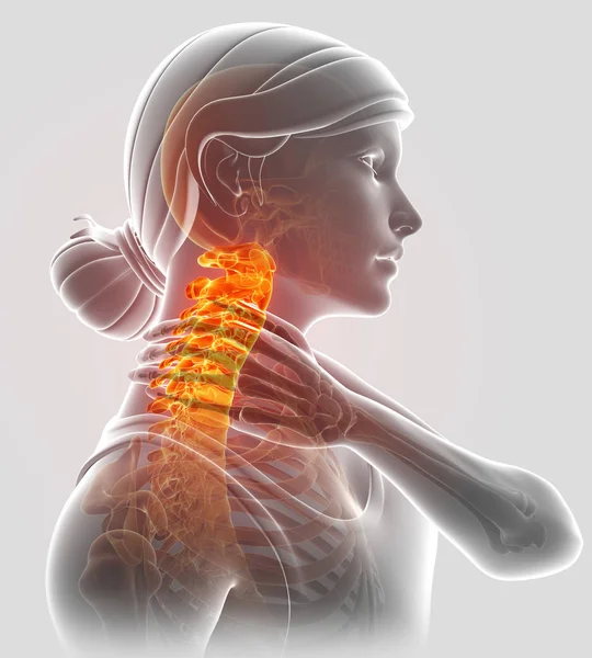 3D ілюстрація того, жінка, відчуваючи біль в шиї — стокове фото