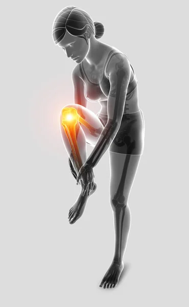 Ilustración 3d de las mujeres sintiendo dolor de rodilla —  Fotos de Stock