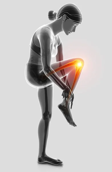 3D απεικόνιση των γυναικών αισθάνεται πόνο στο γόνατο — Φωτογραφία Αρχείου