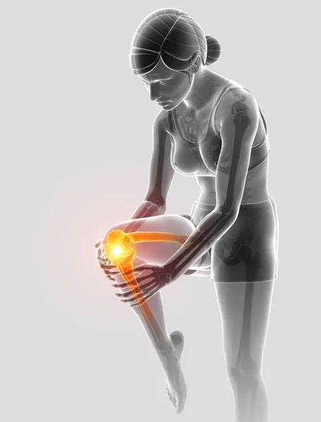 3d Illustration of Women feeling Knee pain — Stock Photo, Image