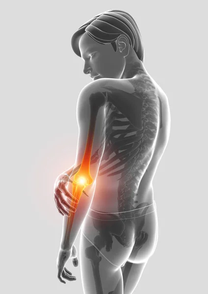 3d Illustration of Male Feeling Elbow pain — Stock Photo, Image