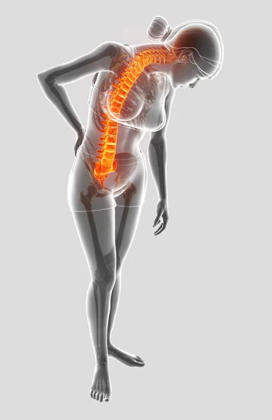 Ilustración 3D de la Mujer Sintiendo el dolor de espalda —  Fotos de Stock