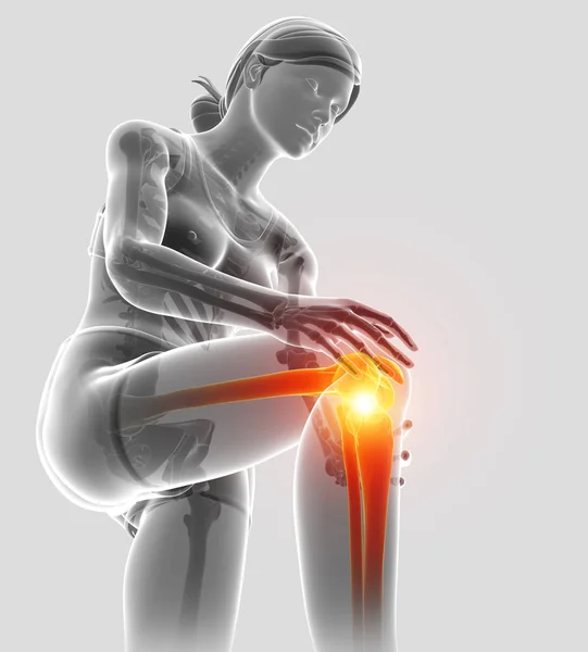 3D obrázek ženy cítí bolest v koleni — Stock fotografie