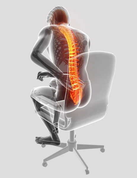 3D απεικόνιση του αρσενικού που αισθάνονται τον πόνο στην πλάτη — Φωτογραφία Αρχείου