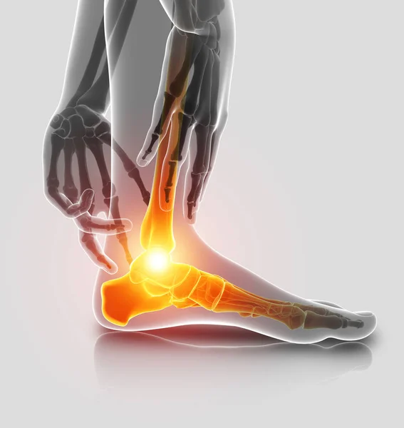 3D ilustracja mężczyzna stóp z bólem w kostce — Zdjęcie stockowe