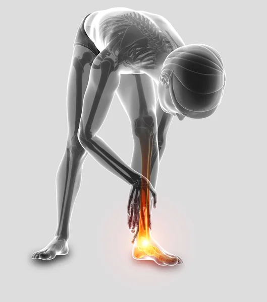 3d Illustration of Male foot with ankle pain