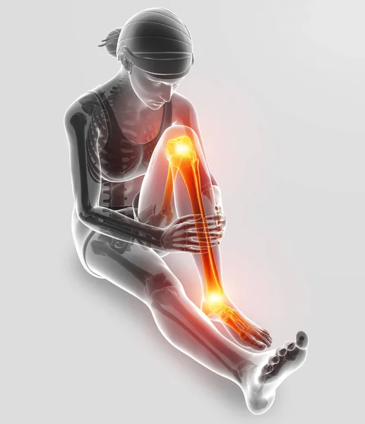 3d Иллюстрация боли в ноге — стоковое фото