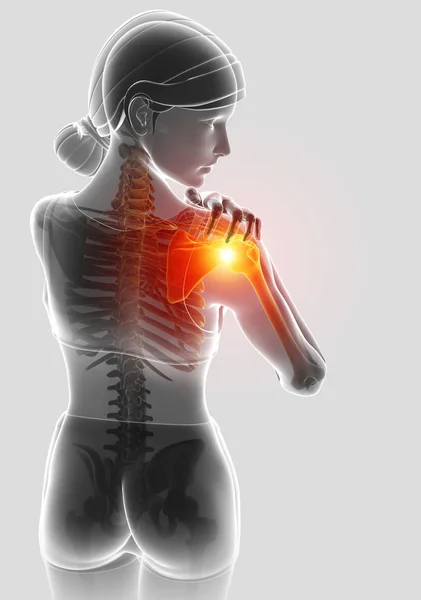 여성 어깨 통증을 느낌의 3d 그림 — 스톡 사진
